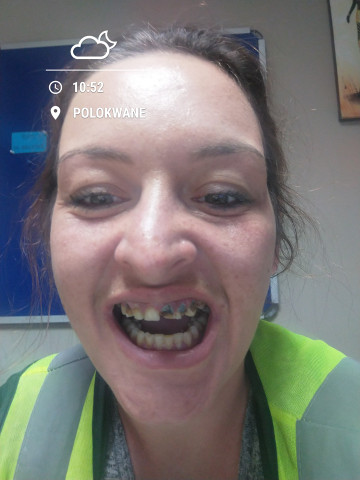 MOMMY NEEDS URGENT DENTAL ASSISTANCE – GOAL R20 000