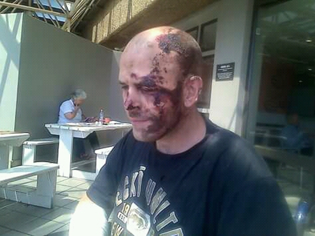 HELP FOR FRIKKIE – GOAL R30 000