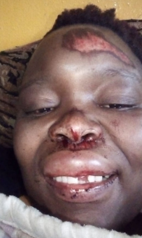 AKHONA: VICTIM TO SURVIVOR –  GOAL R 20 000