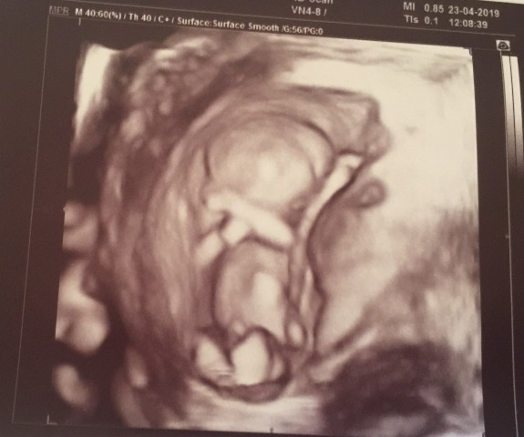 SAVE A UNBORN LIFE – GOAL R 80 000
