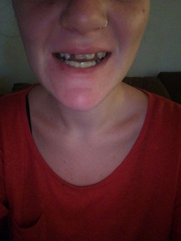 HELP ME SMILE AGAIN!