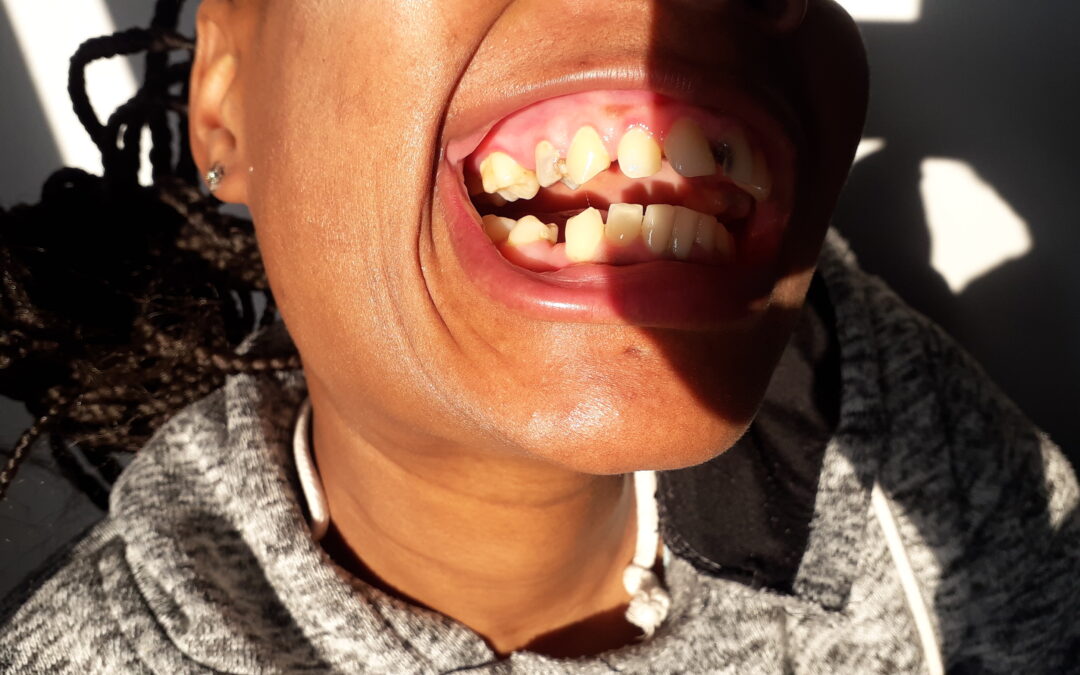 TEETH REPAIR – GOAL R 20 000