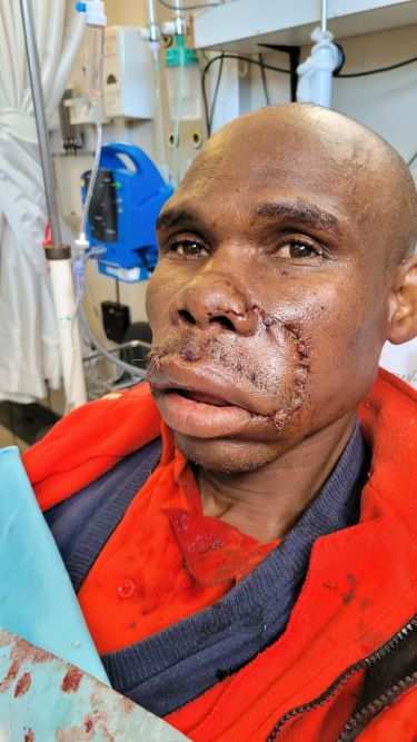 SUPPORT FOR VELA ZITENA – GOAL R 10 000