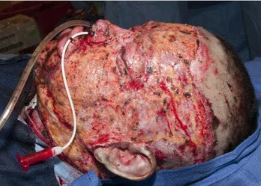 BURNED ALIVE – R 1 638 769