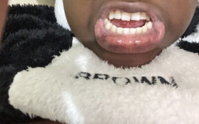 SMILE FOR SELF ESTEEM – R80 000